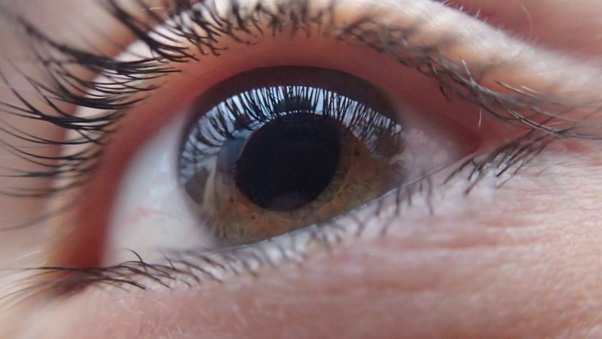 Dream Meaning of Blindness